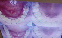 正畸牙医没有给我拍片