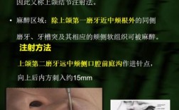口腔浸润麻醉方法操作需注意哪些关键步骤？