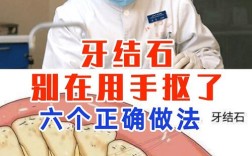 龈下结石去除方法有哪些？专业牙医详解步骤与注意事项解析