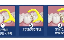 牙齿矫正中线不齐该怎么处理？