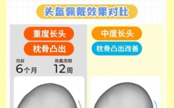 头帽正畸晚上佩戴可行吗？时长和注意事项有哪些？