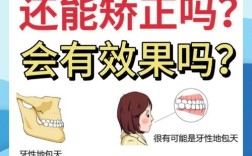 成年地包天有哪些有效纠正方法？