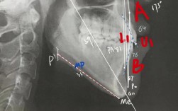 正畸头影测量软件安装时，不同操作系统（Windows/macOS）的具体步骤是什么？安装后如何校准才能保证测量数据准确？