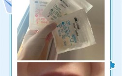 正畸橡皮圈有何用？正畸中如何正确使用？