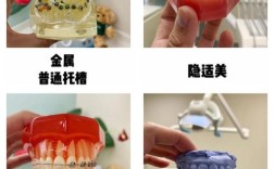 隐形牙齿矫正去哪做好？选靠谱机构要注意啥？