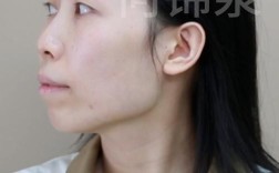 正畸后会影响正颌治疗吗？真的做不了正颌手术吗？