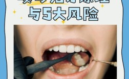 去除牙齿烟渍的好方法是什么？如何快速见效？