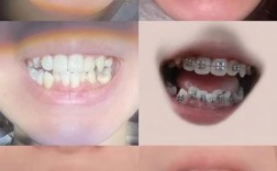 正畸规范面部照