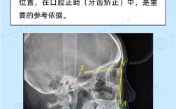 牙科X光拍摄角度怎么选？方法步骤与不同牙位应用技巧