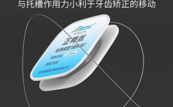 正畸不锈钢丝的优势有哪些，为何能成为正畸优选材料？