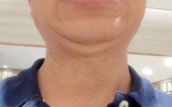 乌鲁木齐牙齿矫正