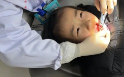 小孩子拔牙方法