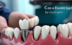 种植牙掉了还能按回去吗？