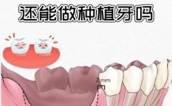 牙骨不太好能种牙吗？