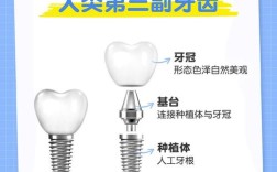 种牙种植体真的能永久使用吗？影响其使用寿命的关键因素有哪些？