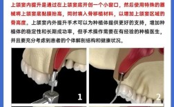 种牙内提和外提的区别究竟是什么？