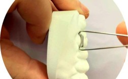 正畸卡环弯制图片