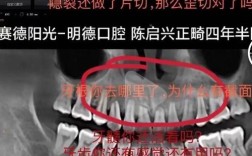 正畸过程中牙齿断了，该怎么办？