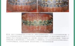 南京口腔正畸王林医生的技术和口碑如何？