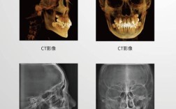 北医正畸头颅测量分析法有何独特优势与应用价值？