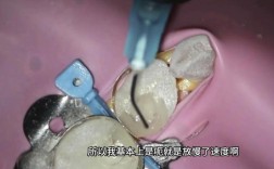 树脂充填器冲洗方法应如何规范操作以达到清洁效果？