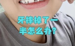 牙根摔掉后，还能通过种植牙修复吗？