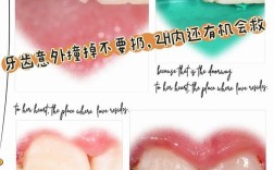 断牙修复最佳方法门牙