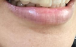 矫正期间牙齿松动正常吗？会自行恢复吗？