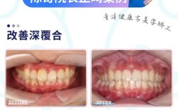 上海想做牙齿正畸，如何找到技术好、价格透明且医生经验丰富的靠谱机构？