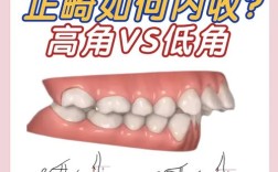 正畸骨量的测量方法有哪些？不同方法的适用场景是什么？