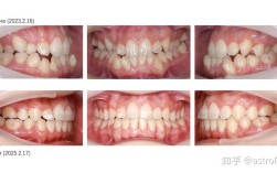 北大口腔医院正畸人多吗