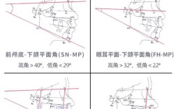 正畸角度测量标准