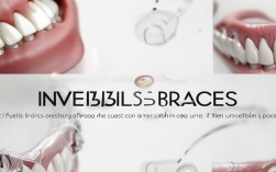 2025隐形牙齿矫正多少钱？最新价格范围更新！