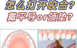 正畸平面导板作用图详解了哪些核心治疗功能？