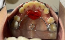 成都牙齿正畸医院哪家好呢？怎么选不踩坑？价格效果如何？