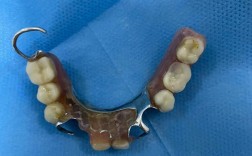 正畸种牙双料活动是什么？优惠如何参与？