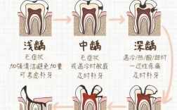 治疗深龋有几种常见方法？不同方法各适用于哪些情况？哪种治疗效果更优且风险较低？