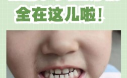 地包天能种牙吗