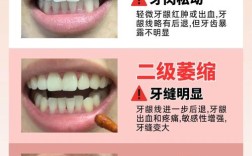 植牙后几天牙龈萎缩了