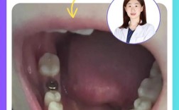 种牙一期后怀孕了