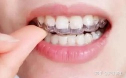 深圳拜博正畸3万