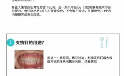 支抗钉上钉的操作步骤与关键技巧是什么？