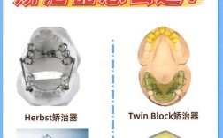 正畸FR是什么意思