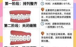 矫正牙齿手术视频教程
