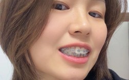 二十多岁矫正牙齿，还来得及吗？