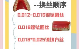 正畸 防止弓丝串位