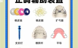 正畸改良基奇顿辅弓的临床应用优势有哪些？