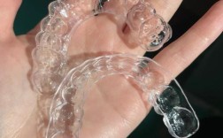 口腔正畸功能保持器有何独特功能与作用？