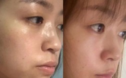 牙齿矫正后脸越来越歪