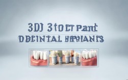 2025年3D种植牙多少钱？最新价格表出炉！